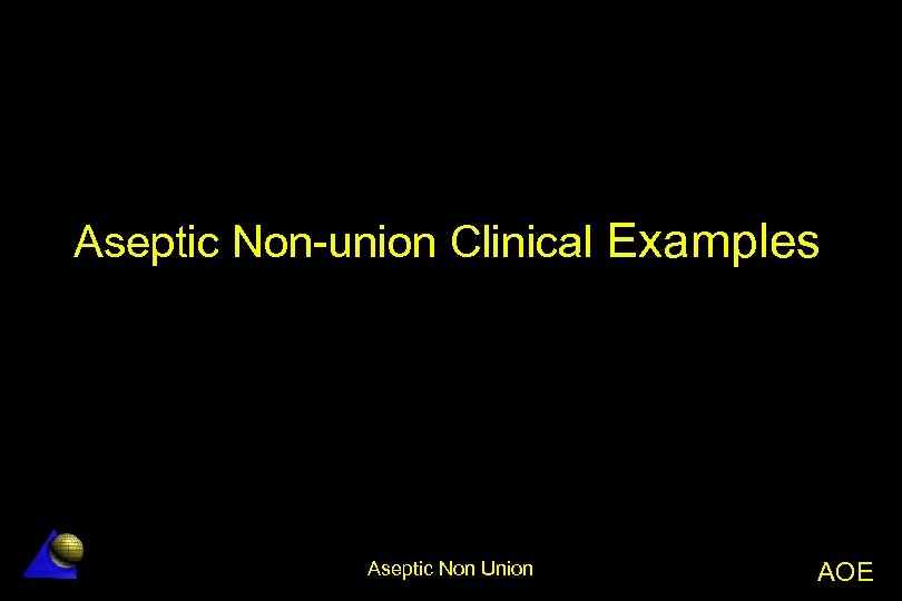 Aseptic NonUnion Aseptic Non Union AOE AO