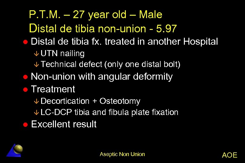P. T. M. – 27 year old – Male Distal de tibia non-union -
