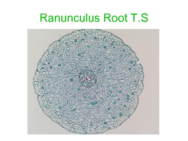 Ranunculus Root T. S 