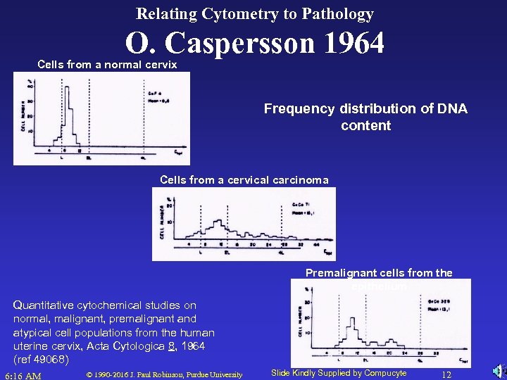 Relating Cytometry to Pathology O. Caspersson 1964 Cells from a normal cervix Frequency distribution