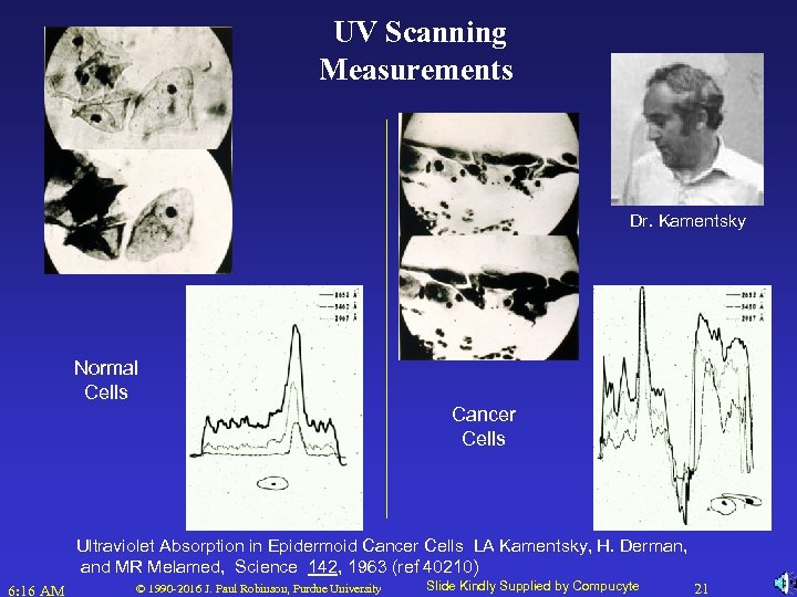 UV Scanning Measurements Dr. Kamentsky Normal Cells Cancer Cells Ultraviolet Absorption in Epidermoid Cancer