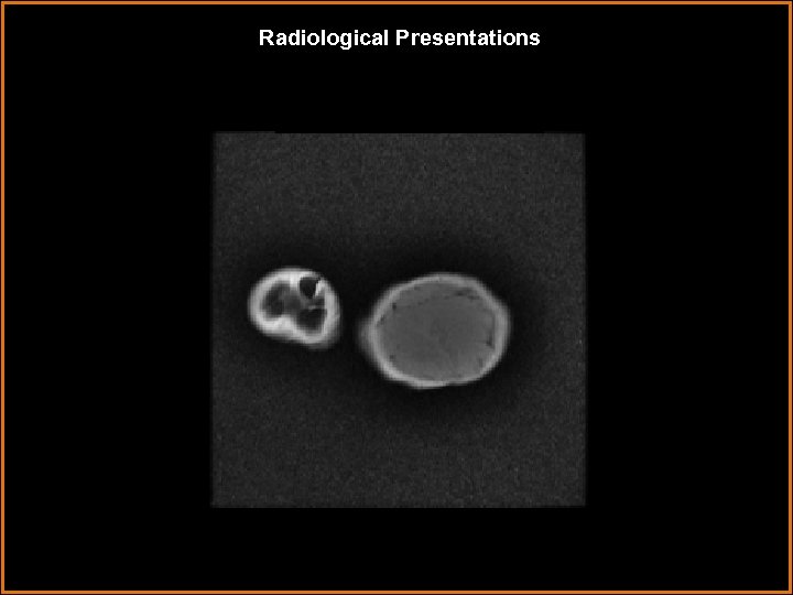 Radiological Presentations 