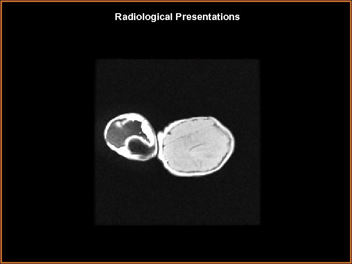 Radiological Presentations 