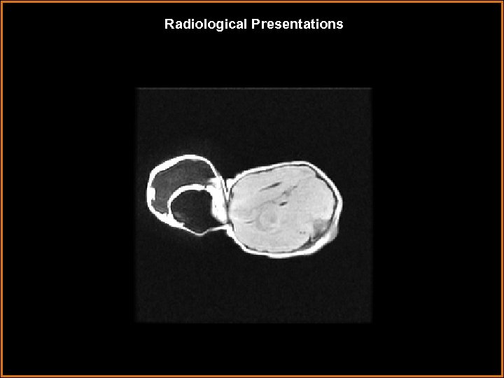 Radiological Presentations 