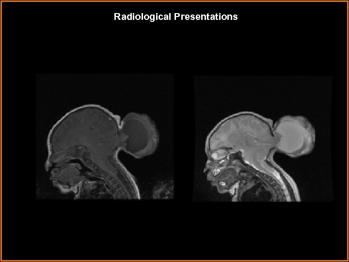 Radiological Presentations 