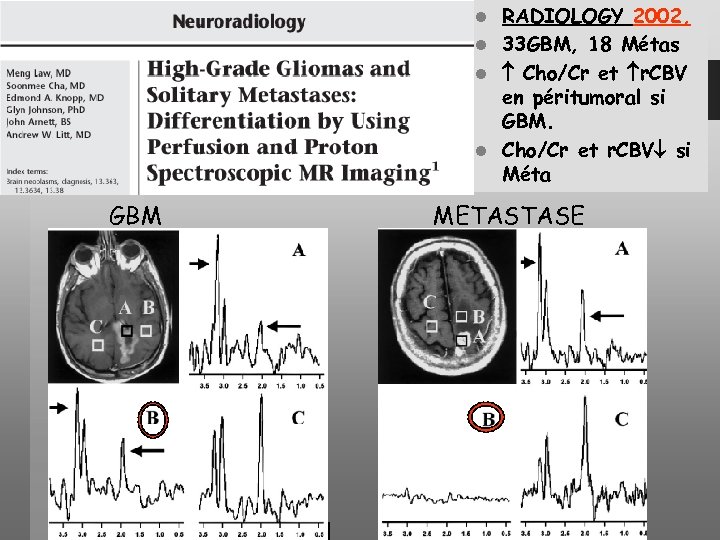 RADIOLOGY 2002, l 33 GBM, 18 Métas l Cho/Cr et r. CBV en péritumoral