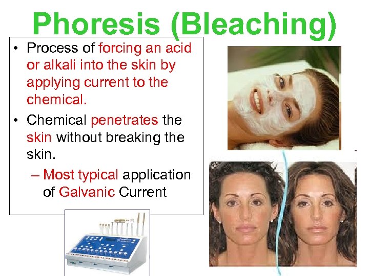 Phoresis (Bleaching) • Process of forcing an acid or alkali into the skin by