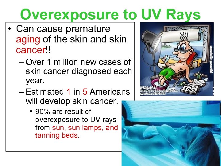 Overexposure to UV Rays • Can cause premature aging of the skin and skin