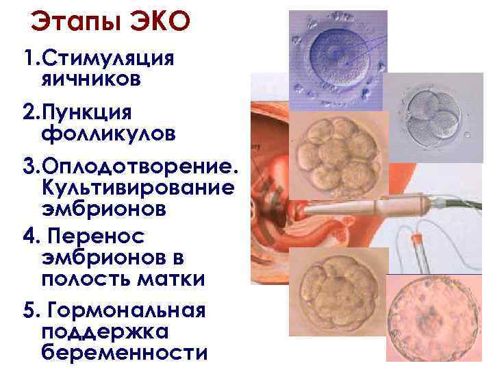 Этапы ЭКО 1. Стимуляция яичников 2. Пункция фолликулов 3. Оплодотворение. Культивирование эмбрионов 4. Перенос
