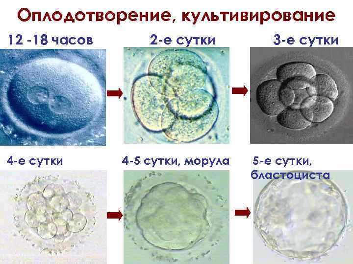 Оплодотворение, культивирование 12 -18 часов 4 -е сутки 2 -е сутки 4 -5 сутки,