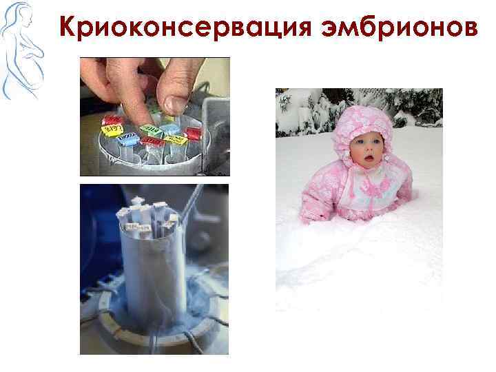 Криоконсервация эмбрионов 