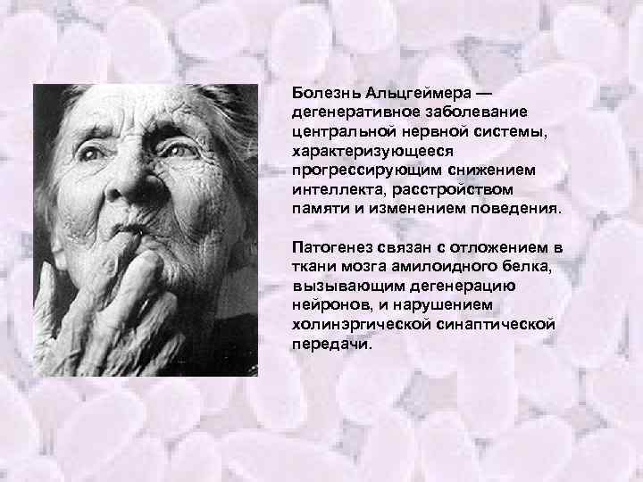 Болезнь Альцгеймера — дегенеративное заболевание центральной нервной системы, характеризующееся прогрессирующим снижением интеллекта, расстройством памяти