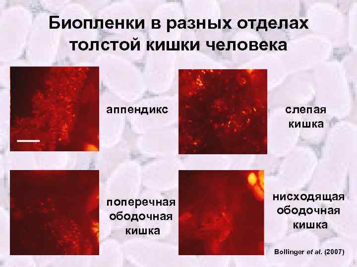 Биопленки в разных отделах толстой кишки человека аппендикс поперечная ободочная кишка слепая кишка нисходящая