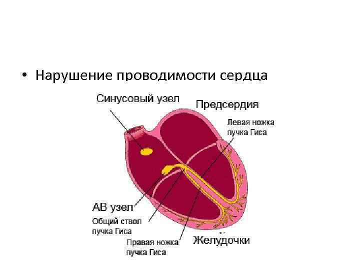  • Нарушение проводимости сердца 