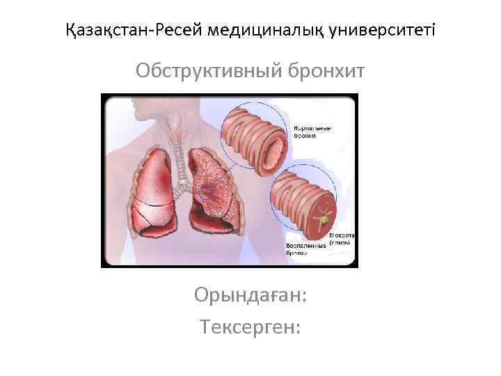 Қазақстан-Ресей медициналық университеті Обструктивный бронхит Орындаған: Тексерген: 