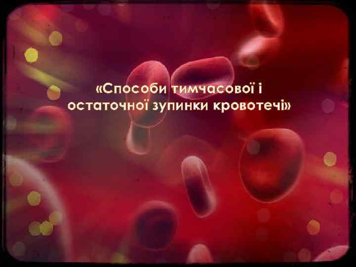  «Способи тимчасової і остаточної зупинки кровотечі» 