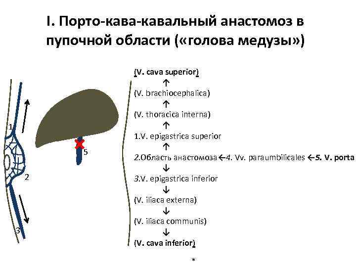 I. Порто-кавальный анастомоз в пупочной области ( «голова медузы» ) 1 5 4 2