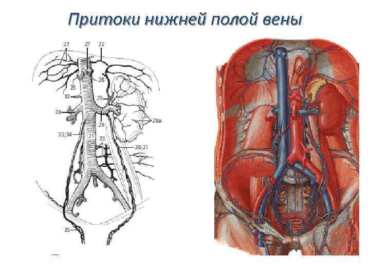 Нижняя полая вена в какой полости. Вены брюшной полости анатомия. Париетальные ветви нижней полой вены. Нижняя полая Вена висцеральные притоки. Система нижней полой вены анатомия.