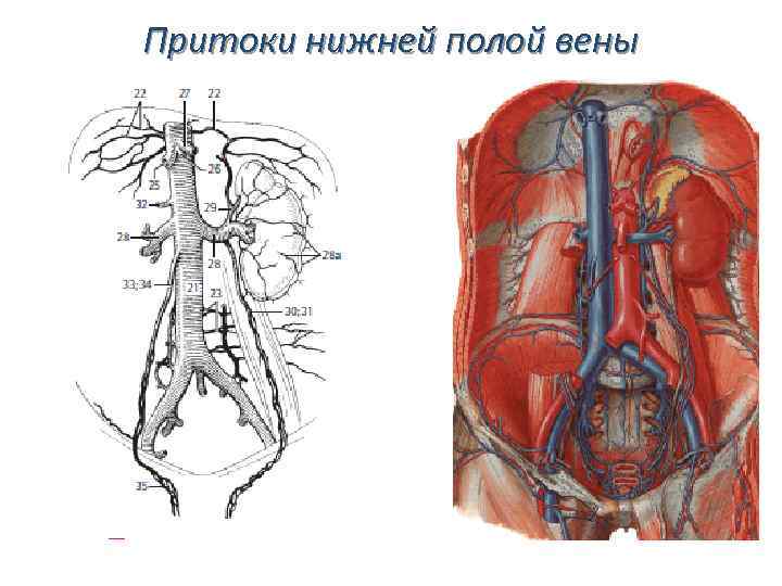 Нижняя полая вена. Париетальные ветви нижней полой вены. Нижняя полая Вена висцеральные притоки. Брюшная аорта и полая Вена. Нижняя полая Вена Вена.