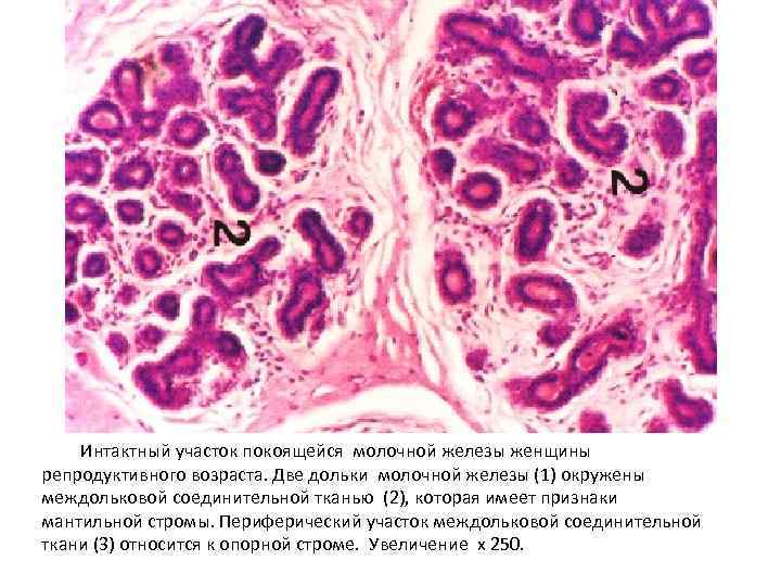 Интактный участок покоящейся молочной железы женщины репродуктивного возраста. Две дольки молочной железы (1) окружены