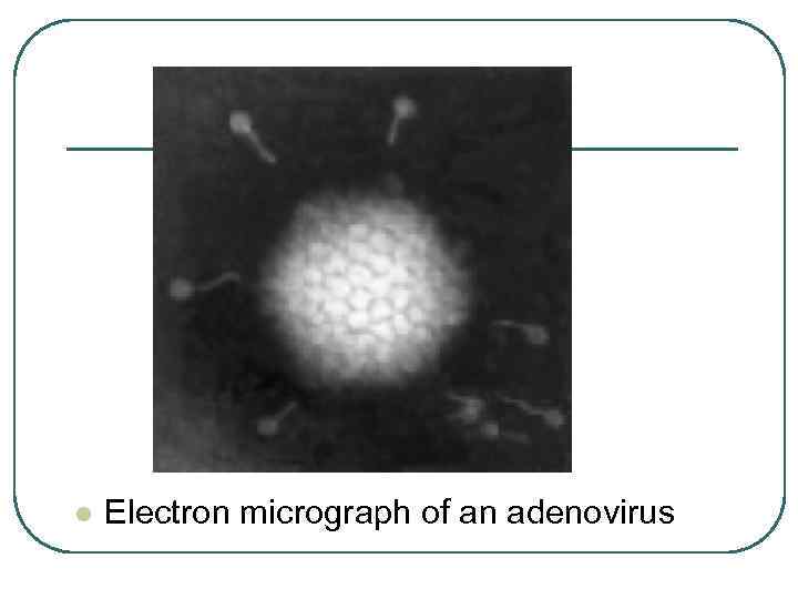 l Electron micrograph of an adenovirus 