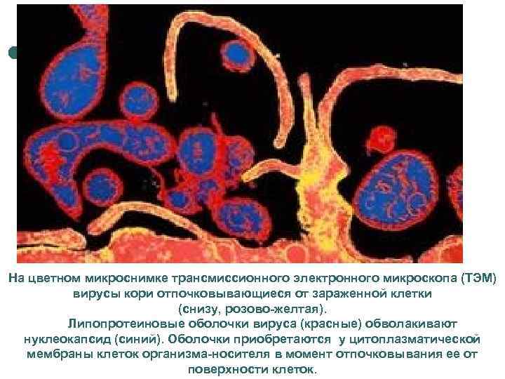 На цветном микроснимке трансмиссионного электронного микроскопа (ТЭМ) вирусы кори отпочковывающиеся от зараженной клетки (снизу,