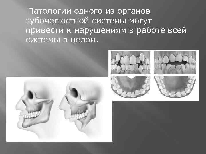  Патологии одного из органов зубочелюстной системы могут привести к нарушениям в работе всей