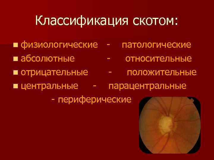 Классификация скотом: n физиологические - патологические n абсолютные относительные n отрицательные положительные n центральные