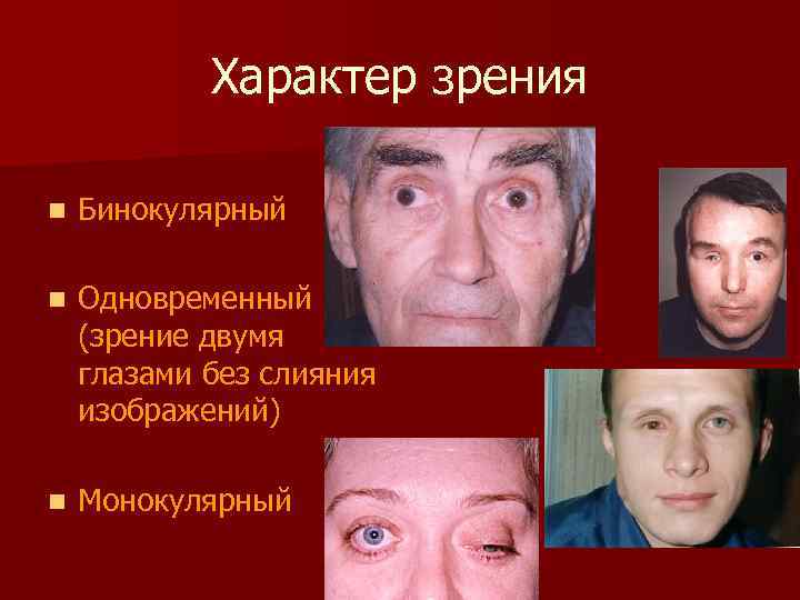 Характер зрения n Бинокулярный n Одновременный (зрение двумя глазами без слияния изображений) n Монокулярный