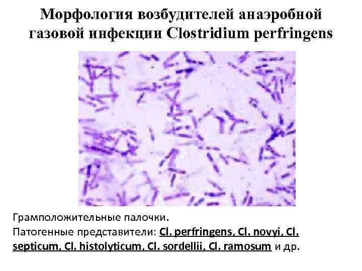 Морфология возбудителей анаэробной газовой инфекции Clostridium perfringens Грамположительные палочки. Патогенные представители: Cl. perfringens, Cl.