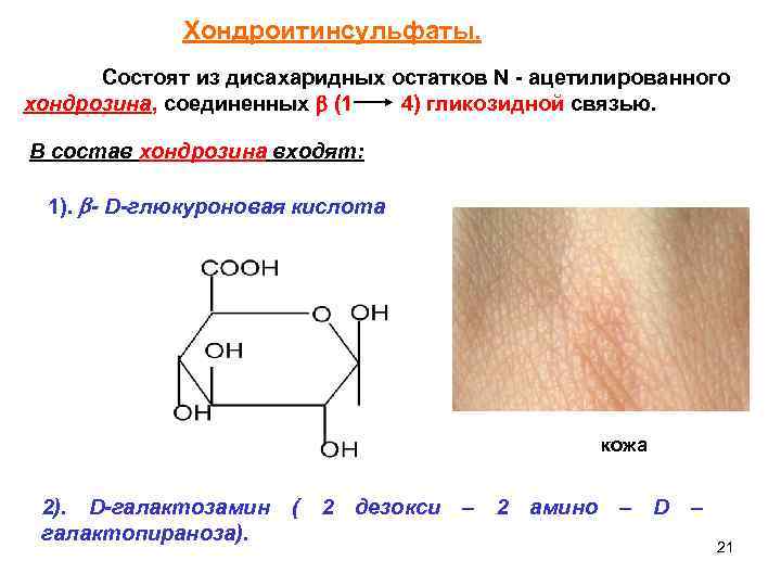 Хондроитинсульфаты. Состоят из дисахаридных остатков N - ацетилированного хондрозина, соединенных (1 4) гликозидной связью.
