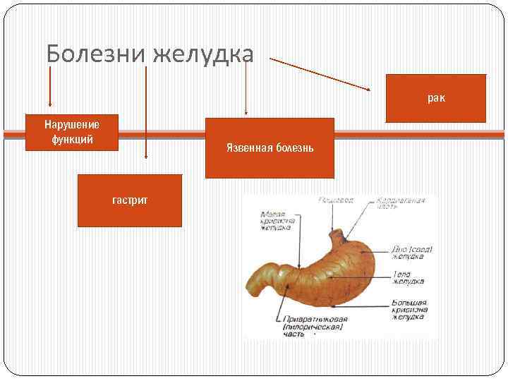 Болезни желудка рак Нарушение функций Язвенная болезнь гастрит 