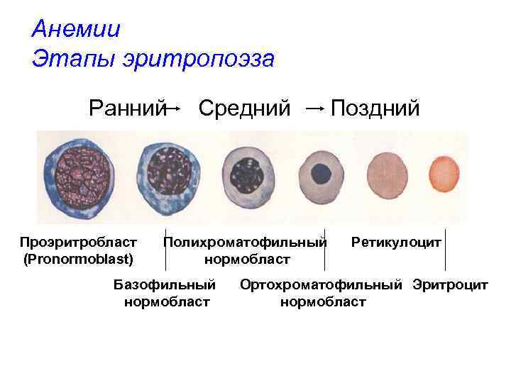 Анемии Этапы эритропоэза Ранний Проэритробласт (Pronormoblast) Средний Полихроматофильный нормобласт Базофильный нормобласт Поздний Ретикулоцит Ортохроматофильный