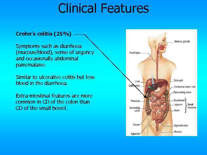 Clinical Features Crohn’s colitis (25%) Symptoms such as diarrhoea (mucous/blood), sense of urgency and