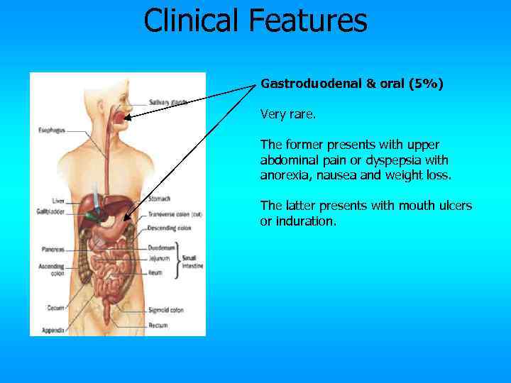 Clinical Features Gastroduodenal & oral (5%) Very rare. The former presents with upper abdominal