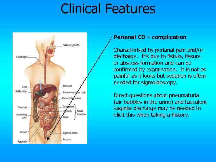 Clinical Features Perianal CD – complication Characterised by perianal pain and/or discharge. It’s due