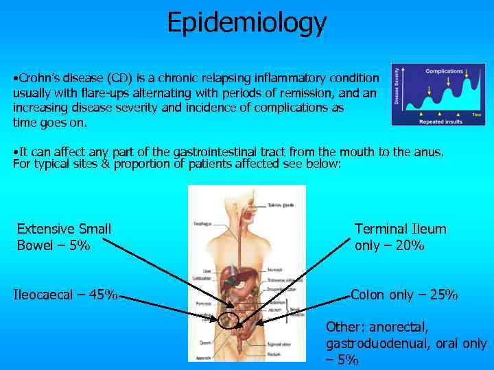 Epidemiology • Crohn’s disease (CD) is a chronic relapsing inflammatory condition usually with flare-ups