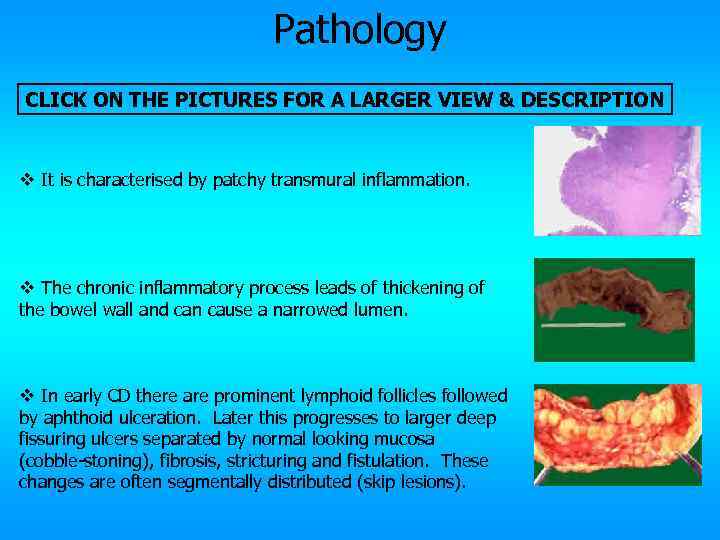 Pathology CLICK ON THE PICTURES FOR A LARGER VIEW & DESCRIPTION v It is