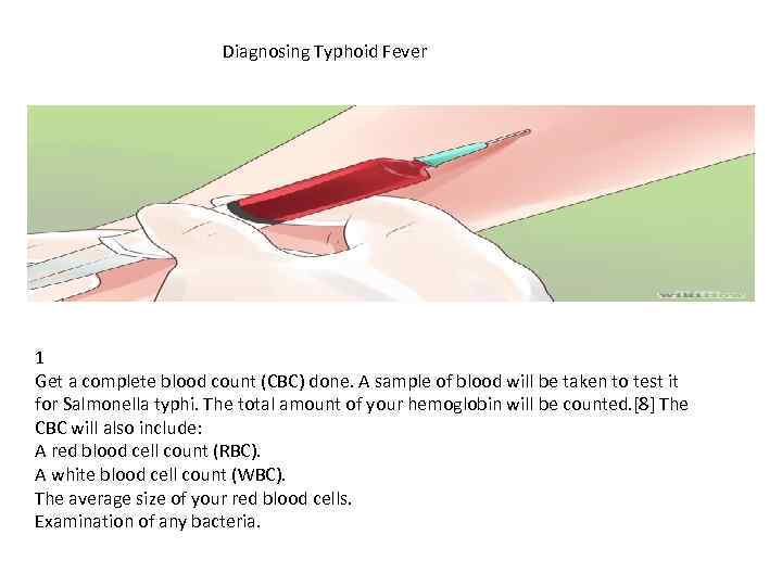 Diagnosing Typhoid Fever 1 Get a complete blood count (CBC) done. A sample of