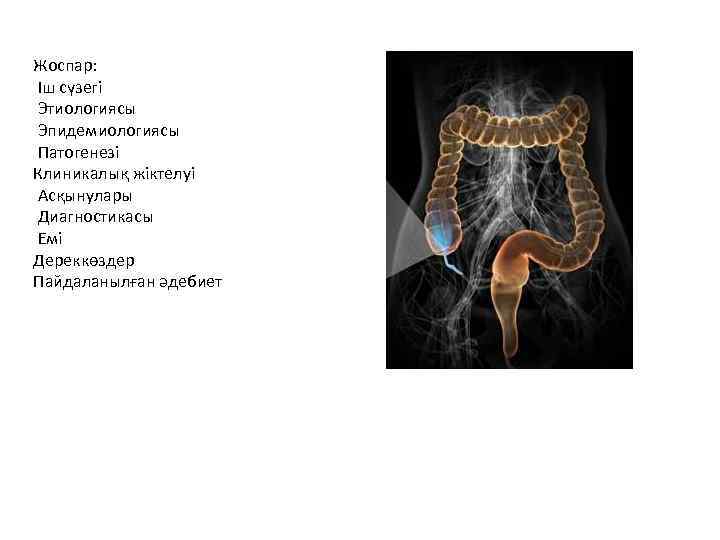 Жоспар: Іш сүзегі Этиологиясы Эпидемиологиясы Патогенезі Клиникалық жіктелуі Асқынулары Диагностикасы Емі Дереккөздер Пайдаланылған әдебиет