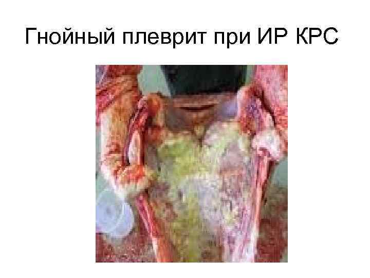 Гнойный плеврит при ИР КРС 