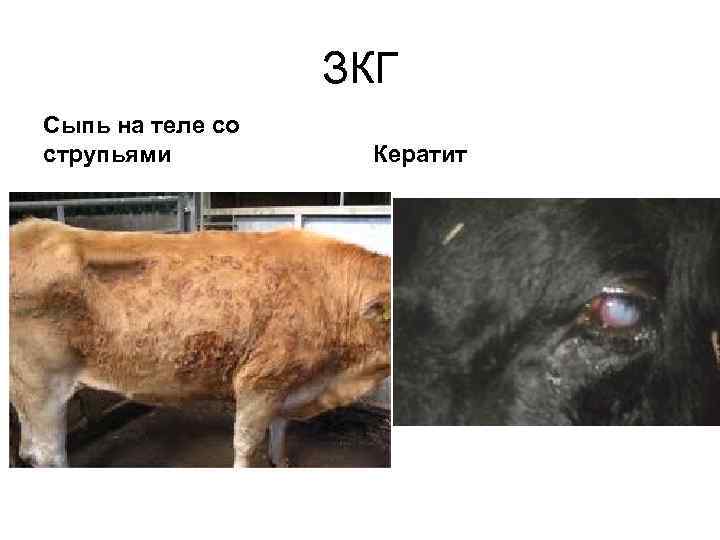 ЗКГ Сыпь на теле со струпьями Кератит 