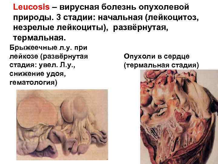 Leucosis – вирусная болезнь опухолевой природы. 3 стадии: начальная (лейкоцитоз, незрелые лейкоциты), развёрнутая, термальная.