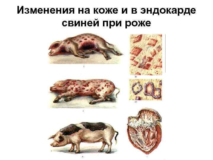 Изменения на коже и в эндокарде свиней при роже 