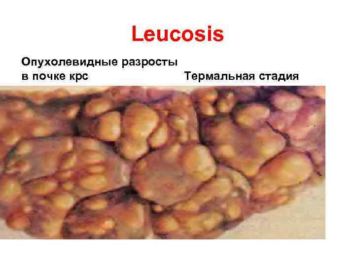 Leucosis Опухолевидные разросты Термальная стадия в почке крс 