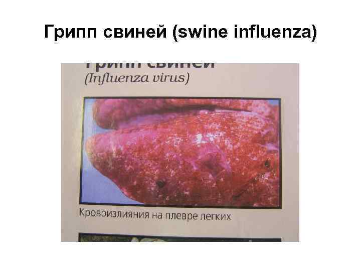 Грипп свиней (swine influenza) 