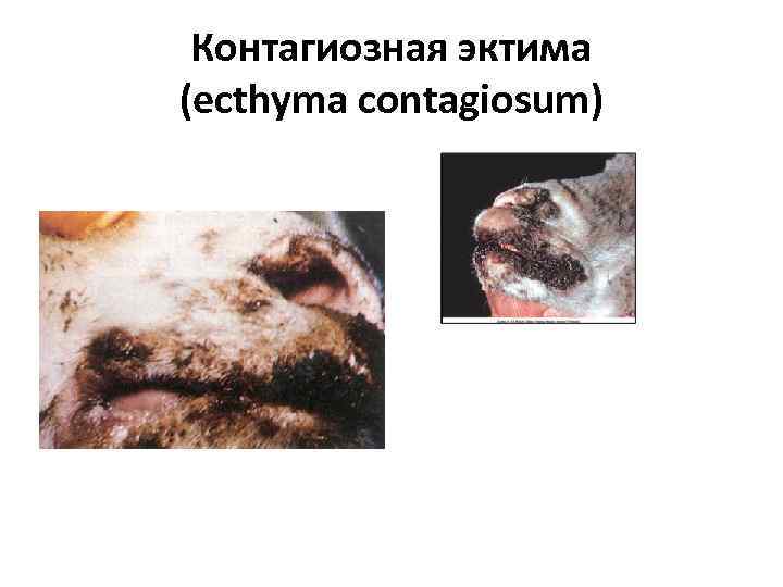 Контагиозная эктима (ecthyma contagiosum) 