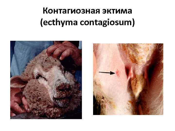 Контагиозная эктима (ecthyma contagiosum) 