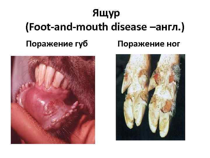 Ящур (Foot-and-mouth disease –англ. ) Поражение губ Поражение ног 