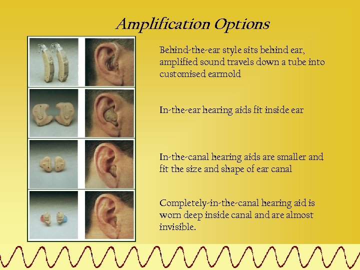 Amplification Options Behind-the-ear style sits behind ear, amplified sound travels down a tube into